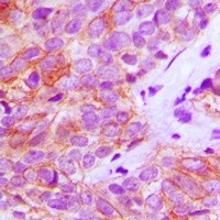 FGFR3 antibody Catalog Number: orb213929图3