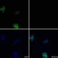 FGFR3 antibody Catalog Number: orb213929图2