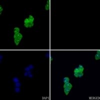 FYB antibody Catalog Number: orb213955图2