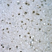 FYB antibody Catalog Number: orb213955图3