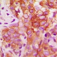 FYN (phospho-Y530) antibody Catalog Number: orb213956图3