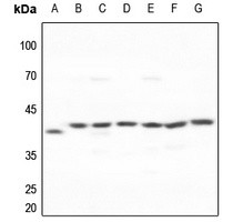 GALK1 antibody Catalog Number: orb213966图2