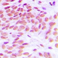 GATA1 antibody Catalog Number: orb213968图3