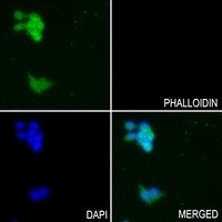 GTF2E2 antibody Catalog Number: orb214024图2