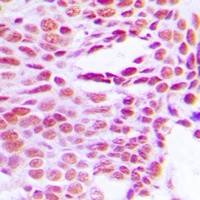 HIST1H1B antibody Catalog Number: orb214030图2