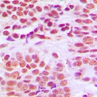HDAC1 antibody Catalog Number: orb214035图3